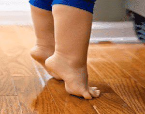 tip toe walking baby causes and treatment