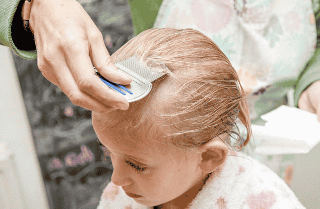 What are the Signs and Symptoms of Head Lice Infestation?