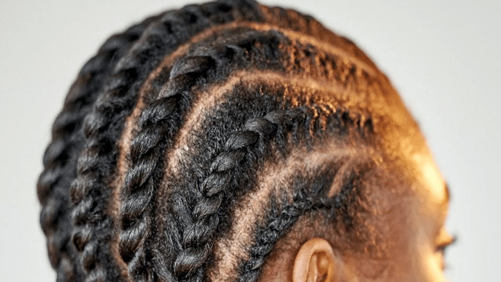 What To Do If Your Braids Are Too Tight?