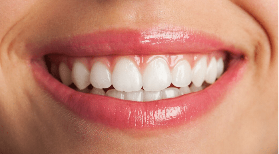 DIY Teeth Whitening: Fact vs. Fiction
