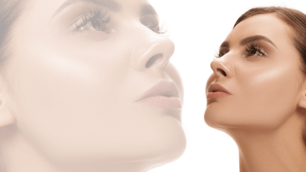 Understanding and Preventing Nasal Collapse After Rhinoplasty