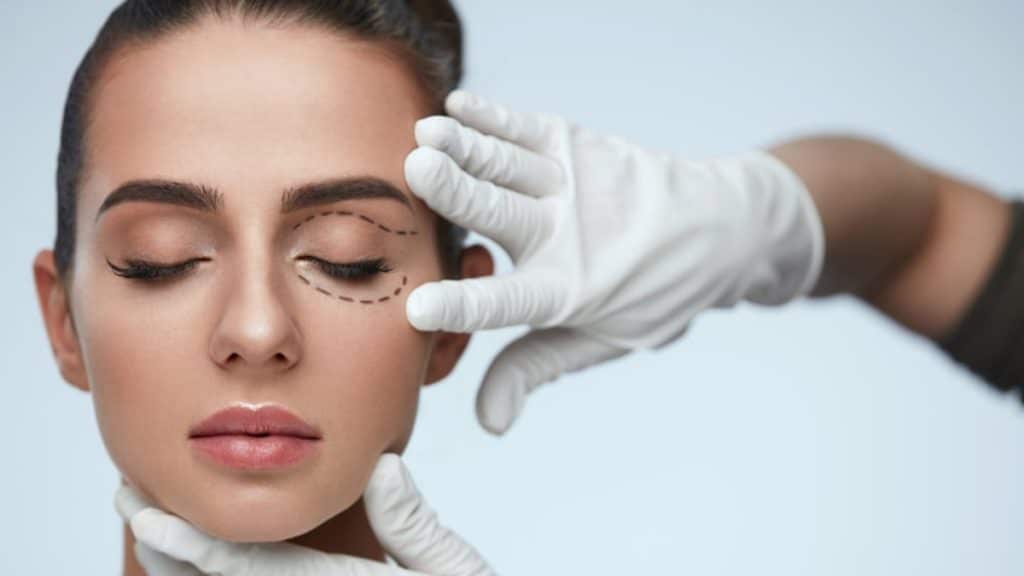 Choosing the Right Surgeon for Double Eyelid Surgery A Comprehensive Guide