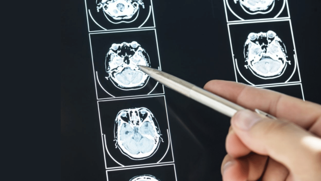 Understanding Brain Injuries Causes and Types