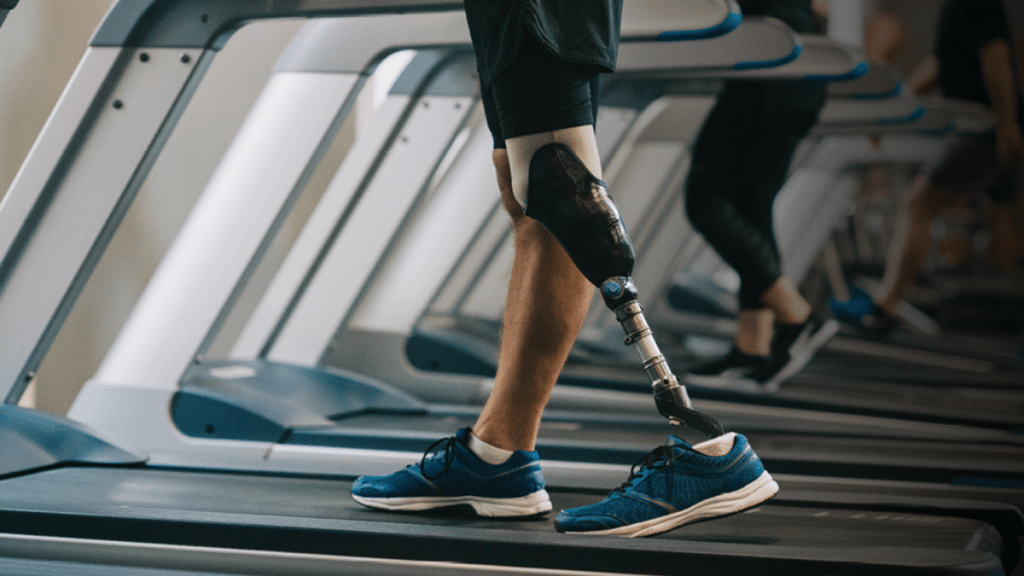 Precision and Performance The Benefits of Custom Prosthetics in Everyday Life