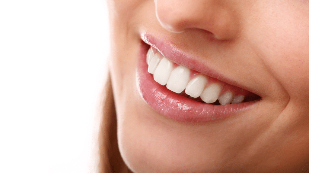 7 Top Dental Tips to Know for Teeth Whitening Aftercare