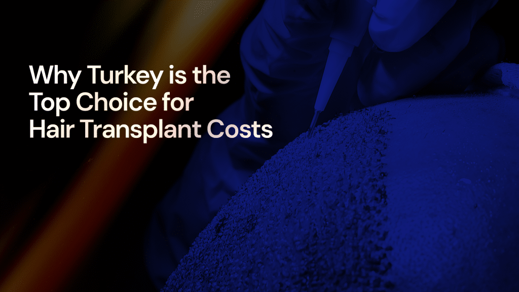 Why Turkey is the Top Choice for Hair Transplant Costs? Costs, Quality, and Complete Packages