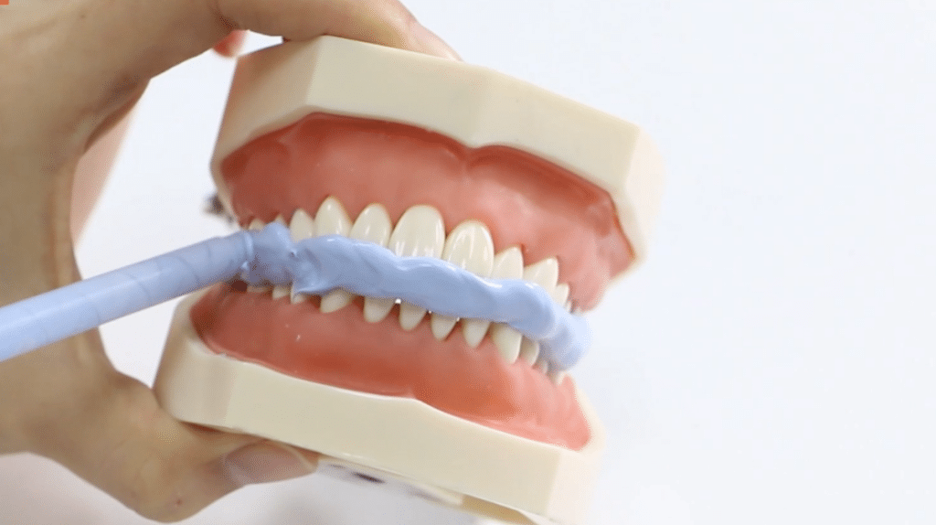 How to Achieve Precise Bite Registration Tips for Dental Professionals