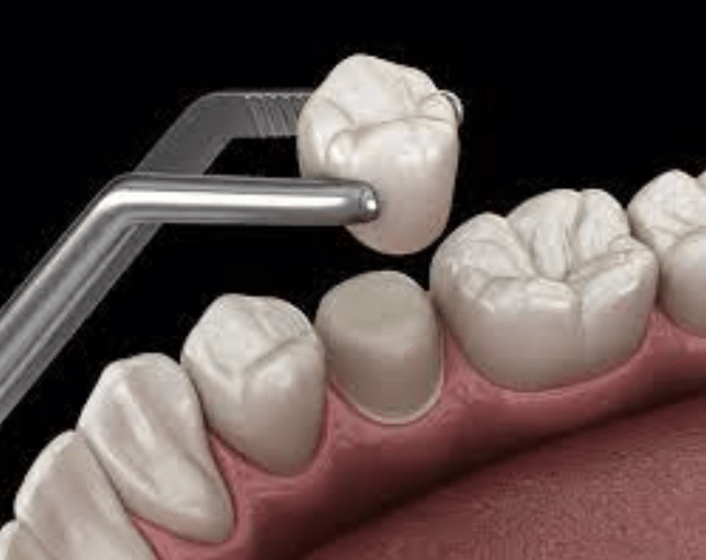 The Connection Between Oral Hygiene and Teeth Alignment