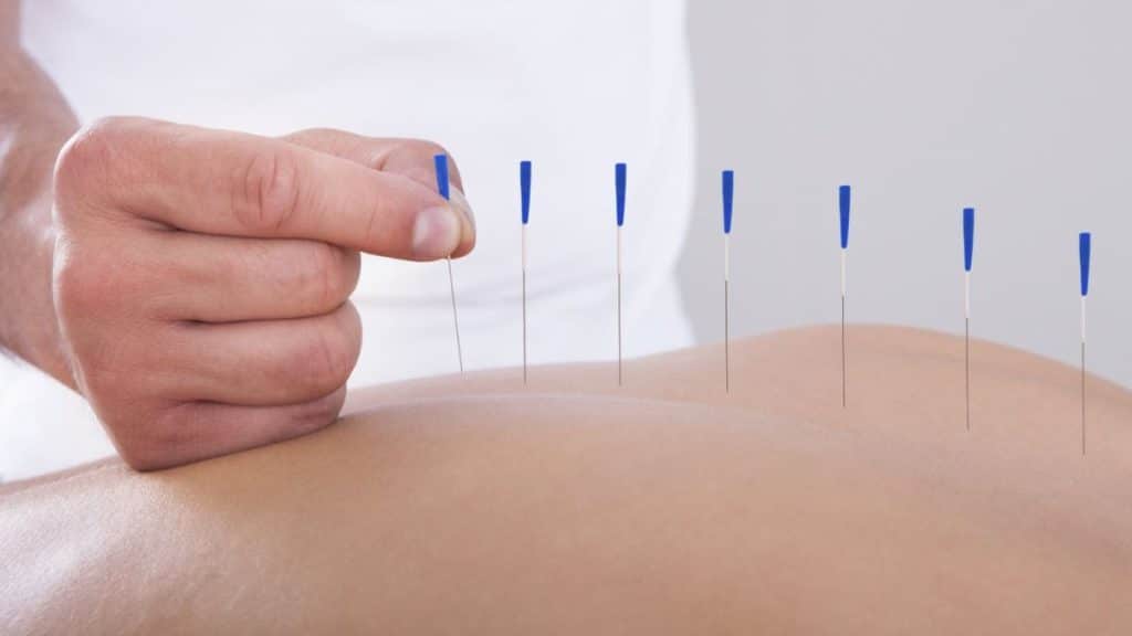 Acupuncture and Pain Management The Truth