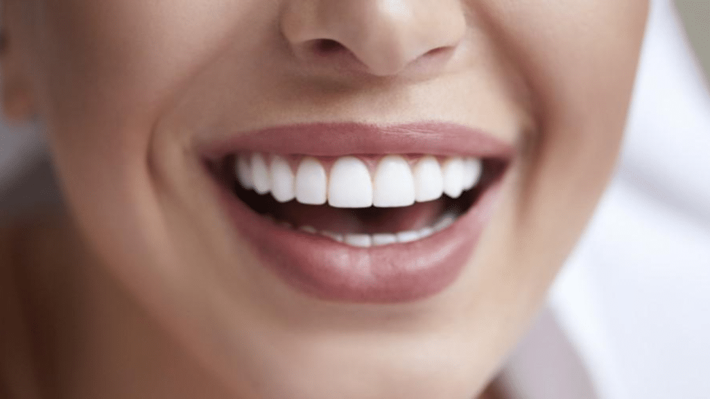 How to Have Perfectly Aligned Teeth!