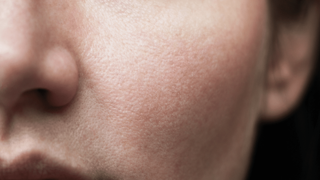 The Link Between Synbiotics and Healthy Skin What You Should Know