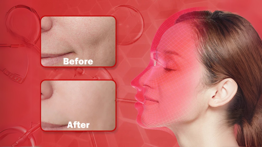 Transform Your Skincare Routine With DermiGlow—Light Therapy Mask