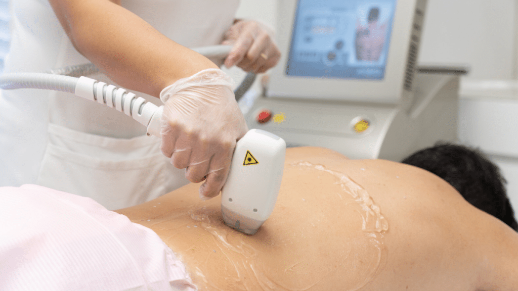 Is Laser Hair Removal in Dubai Safe and Painless