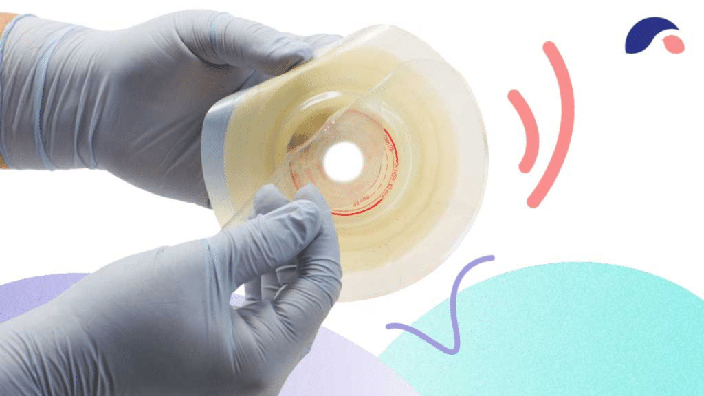 Innovative Approaches to Stoma Care How Silver Foam Is Changing the Game