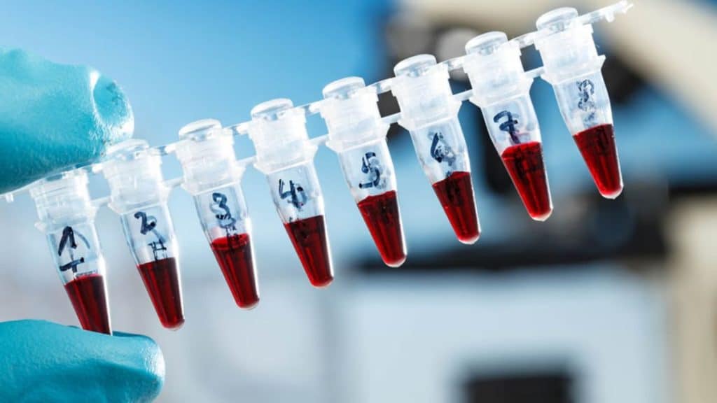 PCR Explained What It Is and Why It Matters in Modern Science