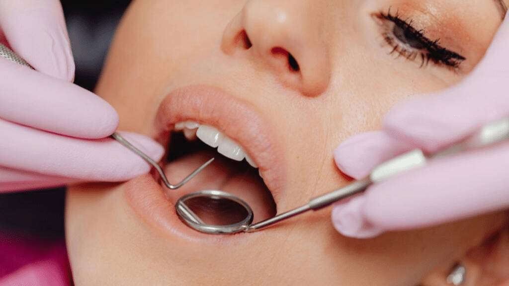 Top Procedures Involved in a Full-Mouth Restoration