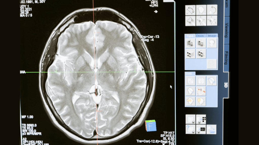 Best Practices for GUI Development in Medical Devices with Qt