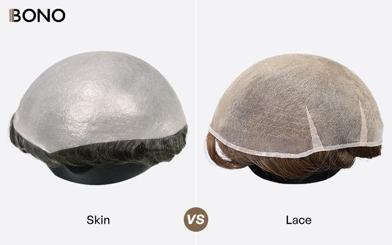 Image 1 of Lace vs. Skin: Which Hair System Base Should You Actually Choose?