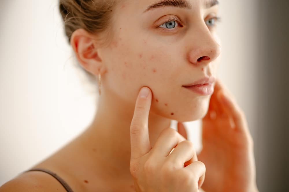 Dr. Boutros Mikhail on Common Skin Conditions Dermatologists Treat