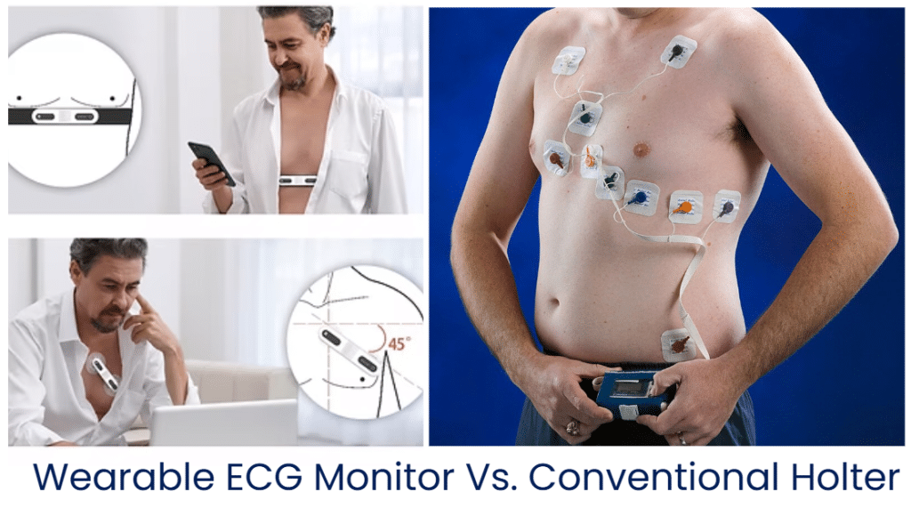 Image 1 of Wearable ECG Monitor Vs. Conventional Holter ECG Monitor