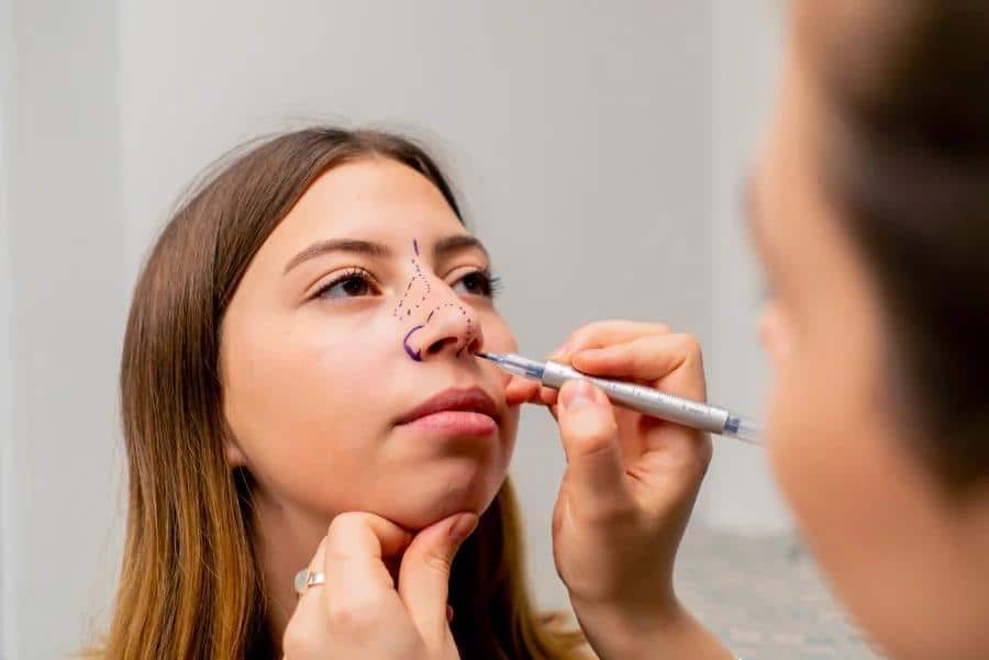 Common Mistakes to Avoid Before Getting Rhinoplasty in Islamabad Image 1 of Common Mistakes to Avoid Before Getting Rhinoplasty in Islamabad